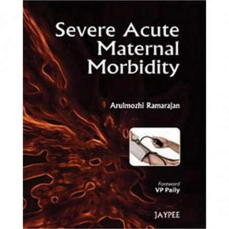 SEVERE ACUTE MATERNAL MORBIDITY book by Ramarajan