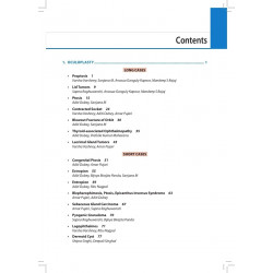 Ophthalmology Clinics-I for Postgraduates, 2/E for MS, MD and DNB Ophthalmology Residents | 32 Long Cases and 48 Short Cases… -
