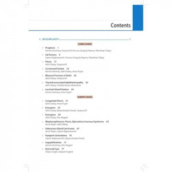 Ophthalmology Clinics-I for Postgraduates, 2/E for MS, MD and DNB Ophthalmology Residents | 32 Long Cases and 48 Short Cases… -