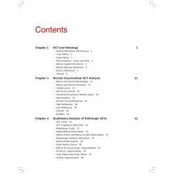 Practical Retinal OCT book by Lumbroso Bruno - Additional Image 5