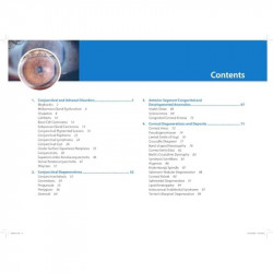 COLOR ATLAS OF CORNEA book by Sujatha Mohan, Madhuvanthi Mohan R Swathi Nishitha - Additional Image 4