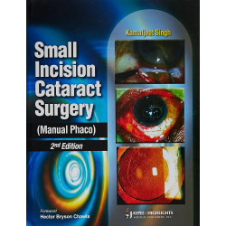 Small Incision Cataract Surgery (Manual Phaco) book by Kamaljeet Singh