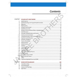 Postgraduate Ophthalmology: An Exam Preparatory Manual for MD/ MS/ DNB/ Diploma Ophthalmology Students | Question Bank with… - A