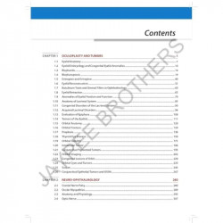 Postgraduate Ophthalmology: An Exam Preparatory Manual for MD/ MS/ DNB/ Diploma Ophthalmology Students | Question Bank with… - A