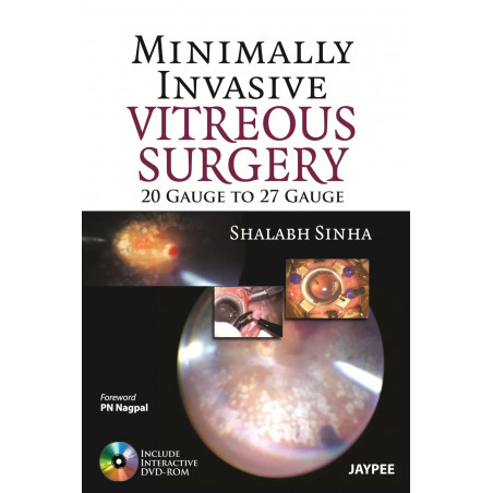 Minimally Invasive Vitreous Surgery: 20 Gauge to 27 Gauge Including DVD-ROM book by Sinha Shalabh