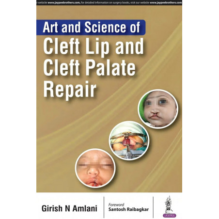 ART AND SCIENCE OF CLEFT LIP AND CLEFT PALATE REPAIR book by Girish N Amlani