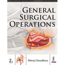 GENERAL SURGICAL OPERATIONS book by Dhiraj Choudhury