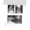 Interesting X-Rays in General Surgery book by Gupta Rp - Additional Image 5