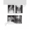 Interesting X-Rays in General Surgery book by Gupta Rp - Additional Image 6