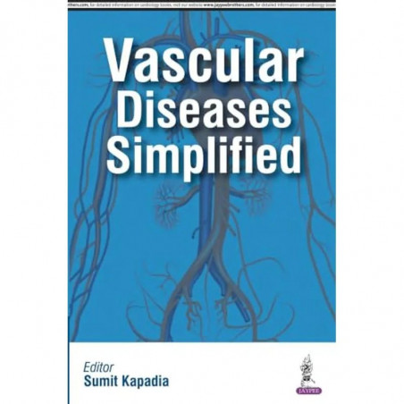 Vascular Diseases Simplified book by Kapadia Sumit