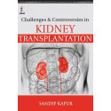 CHALLENGES & CONTROVERSIES IN KIDNEY TRANSPLANTATION book by Kapur Sandip