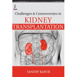 CHALLENGES & CONTROVERSIES IN KIDNEY TRANSPLANTATION book by Kapur Sandip