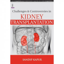 CHALLENGES & CONTROVERSIES IN KIDNEY TRANSPLANTATION book by Kapur Sandip - Back Cover