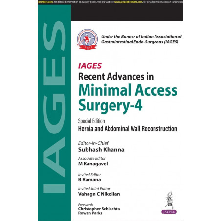 IAGES RECENT ADVANCES IN MINIMAL ACCESS SURGERY- 4 book by Subhash Khanna, M Kanagavel