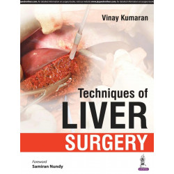 Techniques of Liver Surgery book by Kumaran Vinay