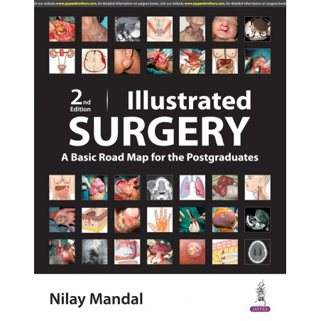 ILLUSTRATED SURGERY A BASIC ROAD MAP FOR THE POSTGRADUATES book by Nilay Mandal