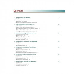 Techniques of Liver Surgery book by Kumaran Vinay - Additional Image 6