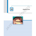 MASTERING THE TECHNIQUES OF LAPAROSCOPIC SUTURING & KNOTTING book by RK Mishra - Additional Image 7