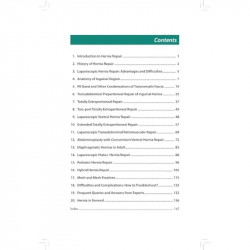 LAPAROSCOPIC HERNIA REPAIR: HOW TO LEARN AT EASE book by R Padmakumar, D Madhukara Pai - Additional Image 6
