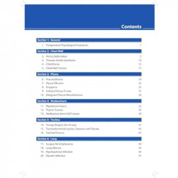 Decision Making in Thoracic Surgery: An Algorithmic Approach book by Wickii T Vigneswaran, John Odell - Additional Image 6