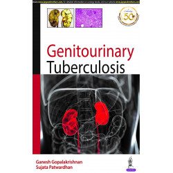 Genitourinary Tuberculosis book by Ganesh Gopalakrishnan, Sujata Patwardhan