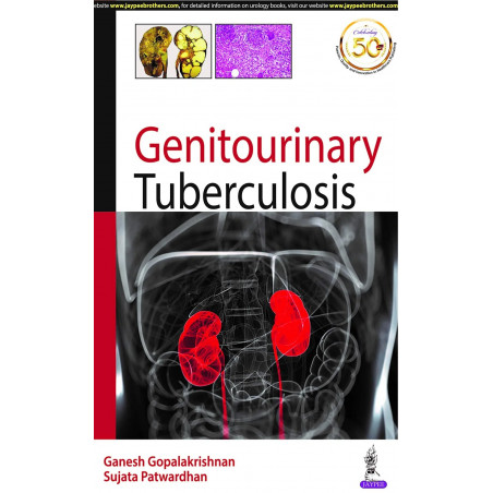Genitourinary Tuberculosis book by Ganesh Gopalakrishnan, Sujata Patwardhan