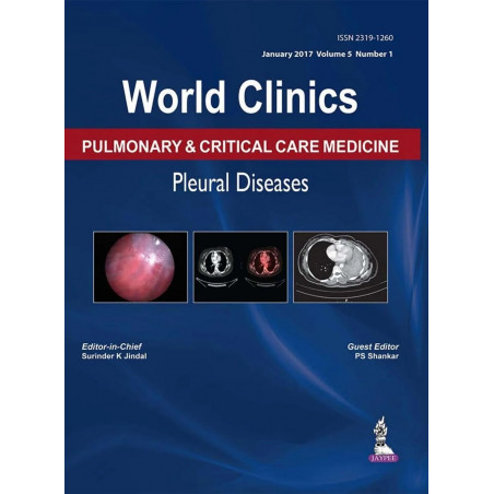 WORLD CLINICS PULMONARY & CRITICAL CARE MEDICINE PLEURAL DISEASES (JAN 2017,VOL.5,NO.1) book by Surinder K Jindal, PS Shankar