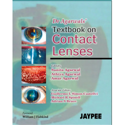 Textbook of Contact Lenses book by Agarwal