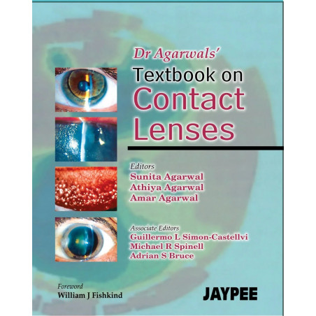 Textbook of Contact Lenses book by Agarwal