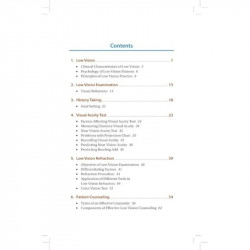 LOW VISION AIDS PRACTICE book by Ajay Kumar Bhootra - Additional Image 6