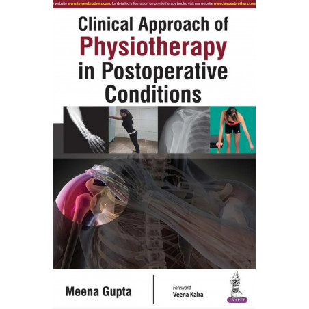 CLINICAL APPROACH OF PHYSIOTHERAPY IN POSTOPERATIVE CONDITIONS book by Gupta Meena