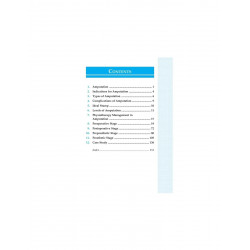 POCKET BOOK OF PHYSIOTHERAPY MANAGEMENT IN AMPUTATION book by Nidhi Khanna - Back Cover