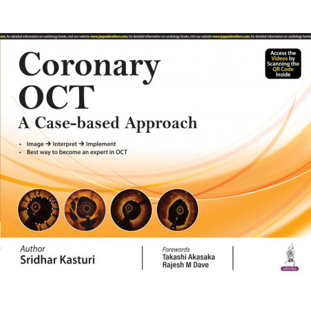 CORONARY OCT A CASE-BASED APPROACH book by SRIDHAR KASTURI