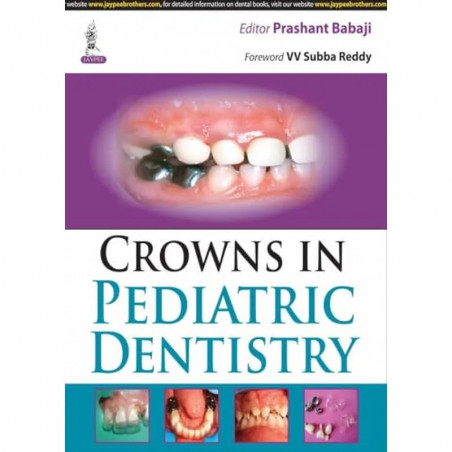 CROWNS IN PEDIATRIC DENTISTRY book by Babaji Prashant