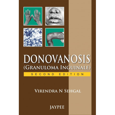 Donovanosis (Granuloma Inguinale) book by Sehgal Virendra N
