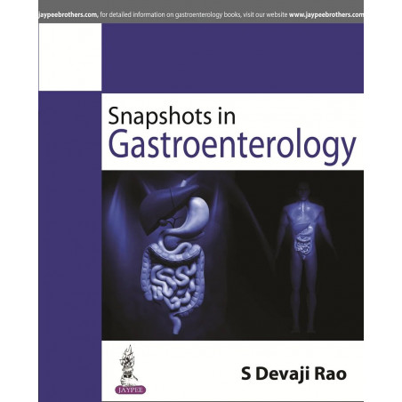 SNAPSHOTS IN GASTROENTEROLOGY book by Rao S Devaji
