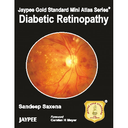 Jaypee Gold Standard Mini Atlas Series: Diabetic Retinopathy book by Sandeep Saxena