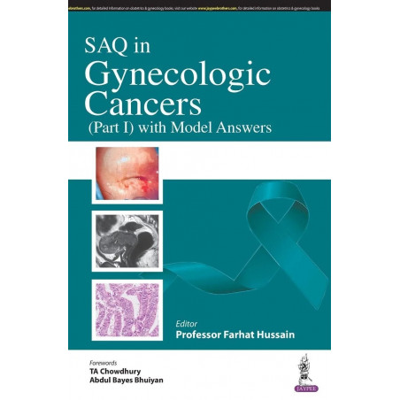 SAQ IN GYNECOLOGICAL CANCERS (PART 1) WITH MODEL ANSWERS book by FARHAT HUSSAIN