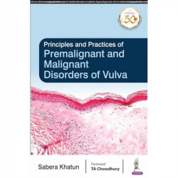 PRINCIPLES AND PRACTICES OF PREMALIGNANT AND MALIGNANT DISORDERS OF VULVA book by Sabera Khatun