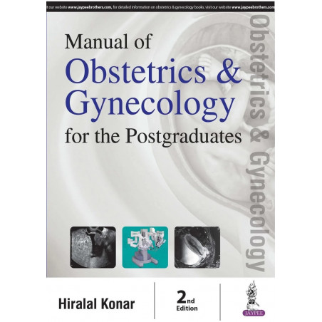 Manual of Obstetrics and Gynecology for the Postgraduates book by Konar Hiralal