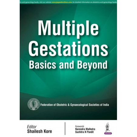 MULTIPLE GESTATIONS:BASICS AND BEYOND book by Kore Shailesh
