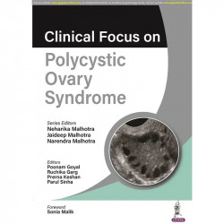 CLINICAL FOCUS ON POLYCYSTIC OVARY SYNDROME book by Neharika Malhotra