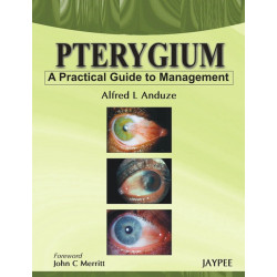 PTERYGIUM A PRACTICAL GUIDE TO MANAGEMENT book by Anduze