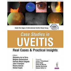Case Studies in Uveitis: Real Cases and Practical Insights for Ophthalmologists, Immunologists, and Trainees in Uveitis | IU…