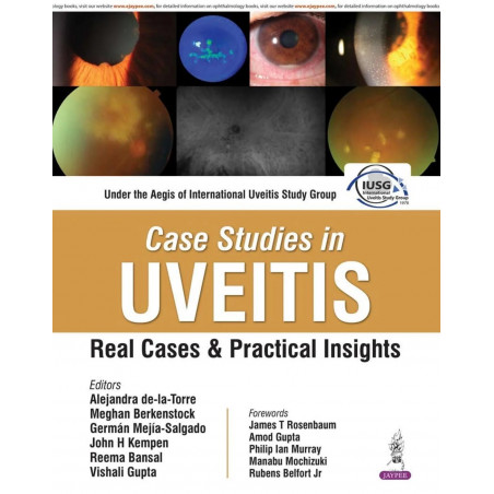 Case Studies in Uveitis: Real Cases and Practical Insights for Ophthalmologists, Immunologists, and Trainees in Uveitis | IU…