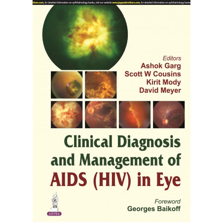 Clinical Diagnosis & Management of AIDS (HIV) in Eye with CD-ROM (POD) book by Garg