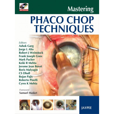 Mastering Phaco Chop Techniques with DVD-ROM (POD) book by Garg