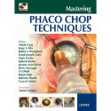 Mastering Phaco Chop Techniques with DVD-ROM (POD) book by Garg - Back Cover