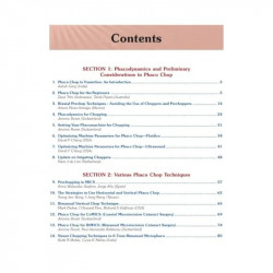 Mastering Phaco Chop Techniques with DVD-ROM (POD) book by Garg - Additional Image 4