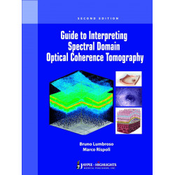 Guide to Interpreting Spectral Domain Optical Coherence Tomography book by Lumbroso, Rispoli